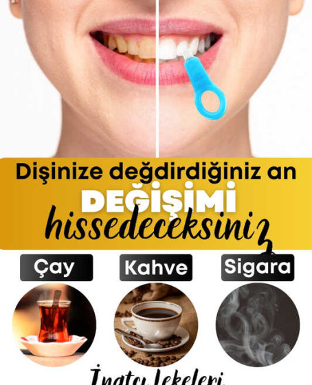 Diş Leke Silgisi 1 Aparatlı + 5 Yedek Süngerli Set 1 Paket