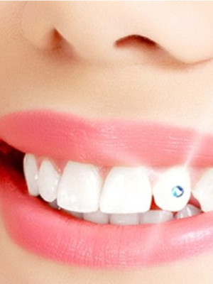 Diş Kristali ve Diş Pırlantası Komple Set - Muhteşem Gülüş Seti