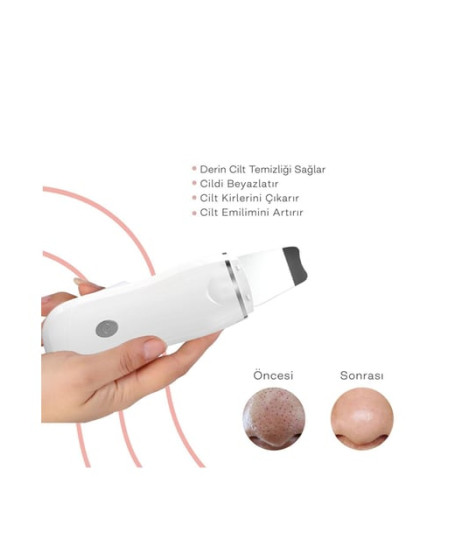 Ultrasonik Spatula Yüz Akne Giderici Siyah Nokta Temizleme Cihazı