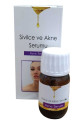 Sivilce Ve Akne Serumu 20 ML