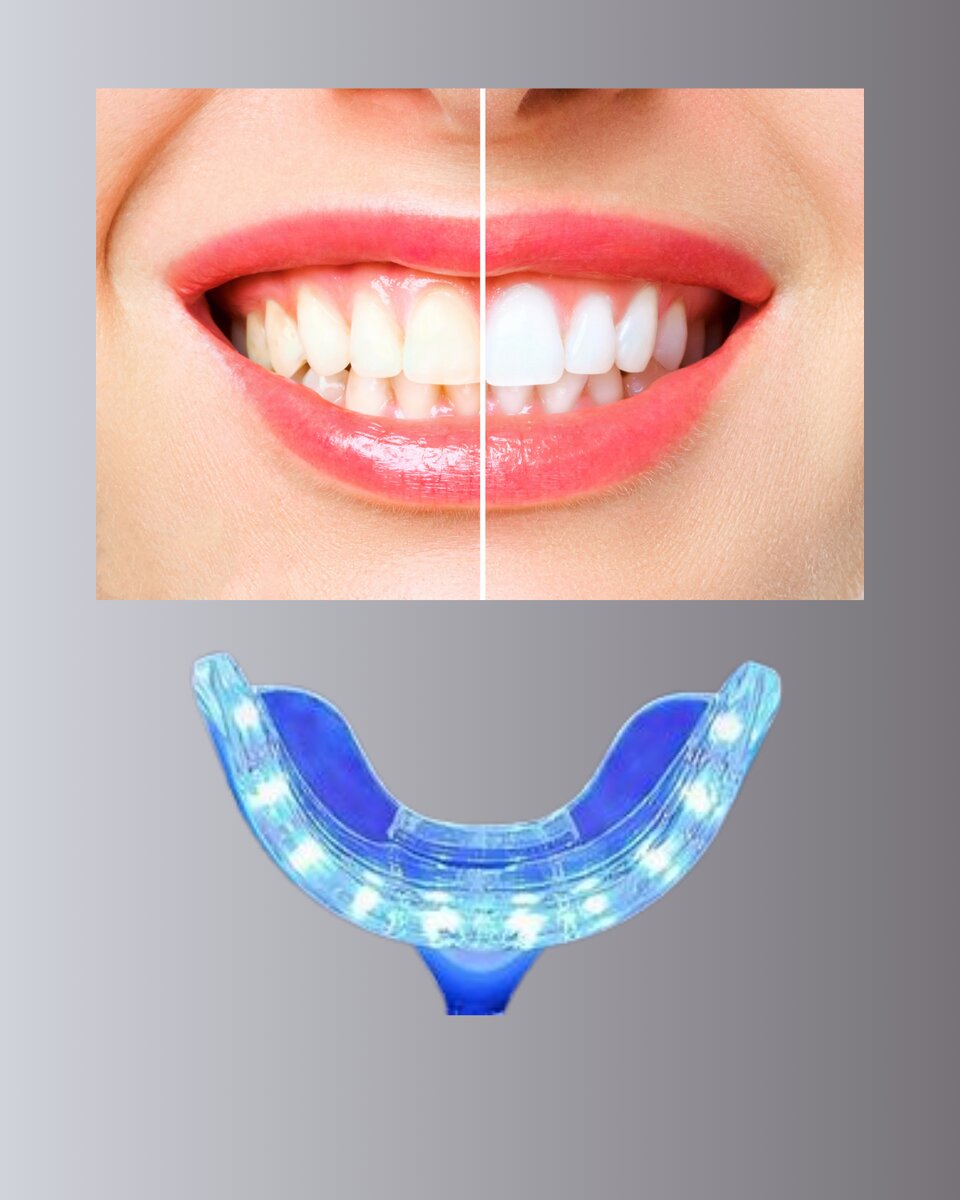 LED Işıklı Profesyonel Diş Beyazlatma Seti LED Işıklı Profesyonel Diş Beyazlatma Seti