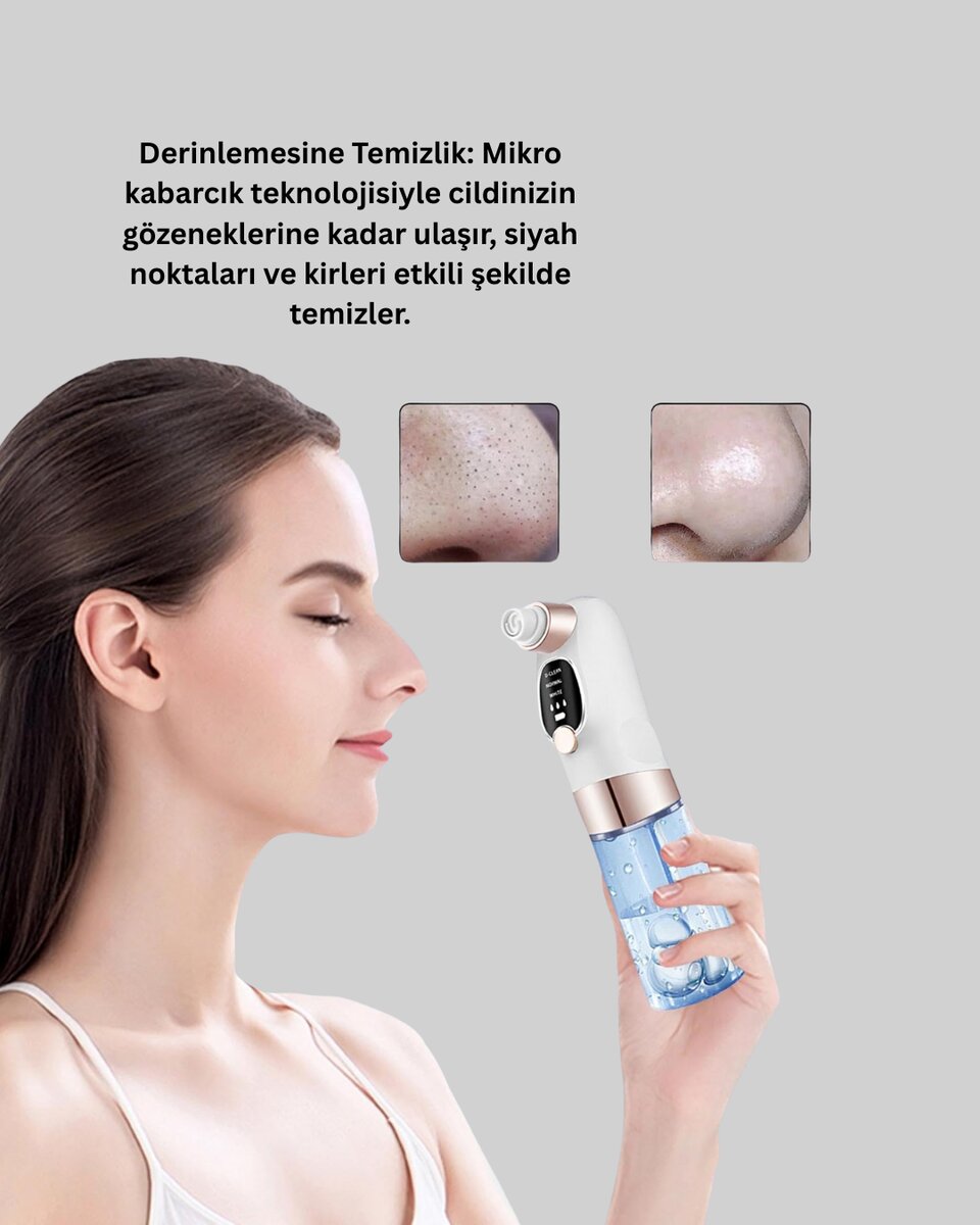 Titreşimli Elektrikli Gözenek Açıcı – Siyah Nokta ve Yağ Arındırıcı Titreşimli Elektrikli Gözenek Açıcı – Siyah Nokta ve Yağ Arındırıcı