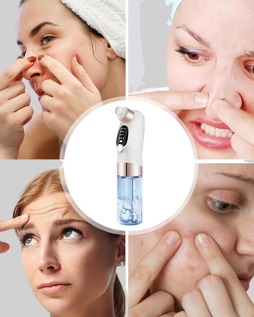 Elektrikli Siyah Nokta Sökücü – Derinlemesine Gözenek Temizleme Cihazı Elektrikli Siyah Nokta Sökücü – Derinlemesine Gözenek Temizleme Cihazı