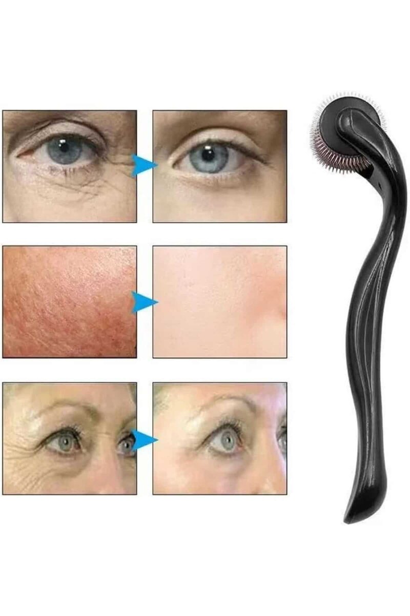 Dermaroller Titanyum 540 Iğneli 1 Mm Saç Kaş Sakal Serum Kullanıma Uygun Dermaroller Titanyum 540 Iğneli 1 Mm Saç Kaş Sakal Serum Kullanıma Uygun