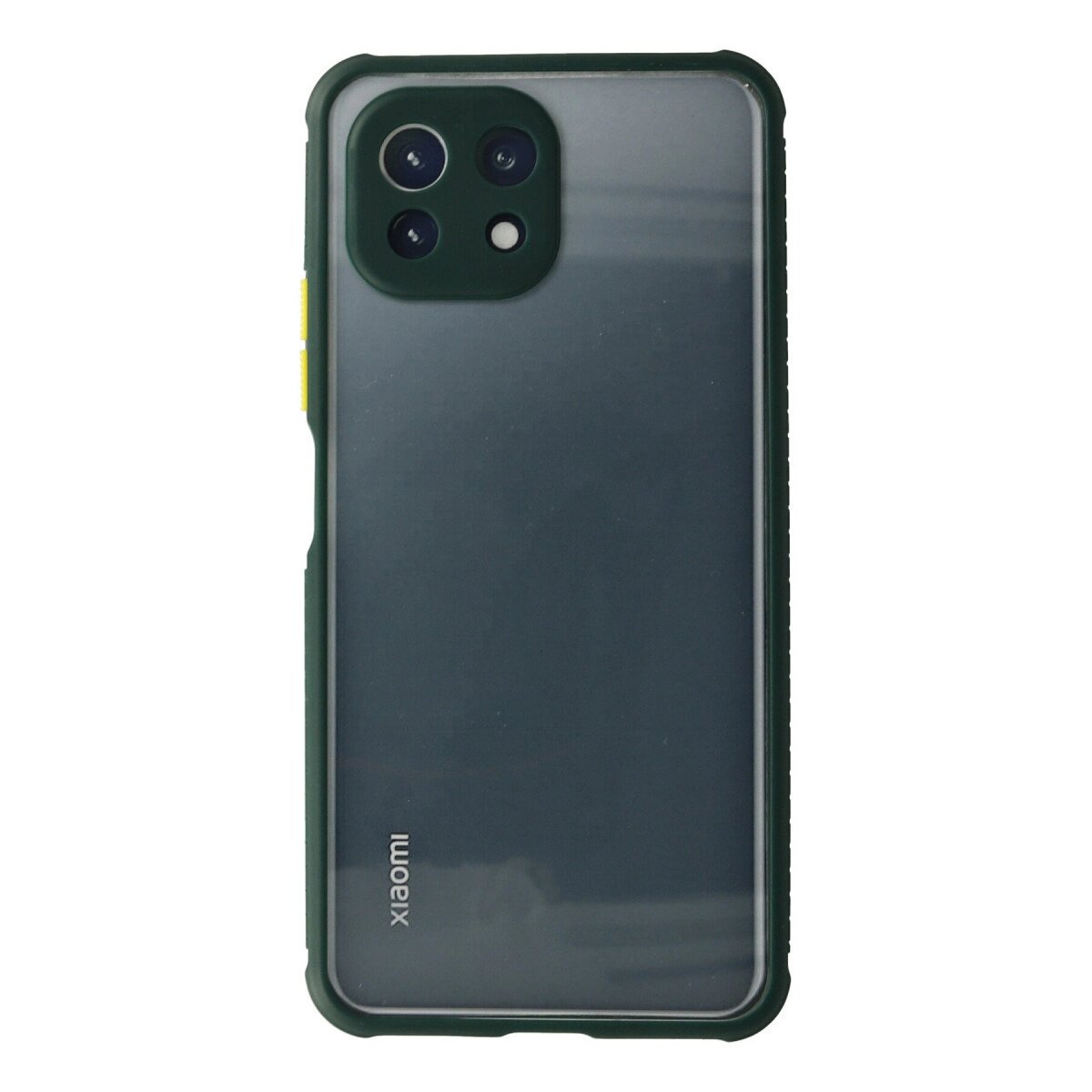 Xiaomi Mi 11 Lite Kılıf Miami Şeffaf Silikon - Koyu Yeşil Xiaomi Mi 11 Lite Kılıf Miami Şeffaf Silikon - Koyu Yeşil
